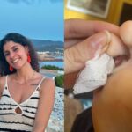 The ordeal of a woman who was bitten by the fiddler spider and visited 40 doctors: «In Ibiza they wanted to amputate me, they saved me in Madrid».
