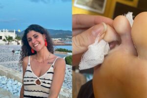Andrea Valverde, tambi&eacute;n v&iacute;ctima de la ara&ntilde;a en Ibiza. (Foto: gentileza Andrea Valverde)