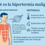 Infografía sobre la hipertermia maligna