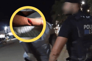 Brazo cortado y hombre detenido. Foto de la Policía Local de Sant Josep