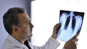 card Male doctor assessing x ray results card Male doctor assessing x ray results