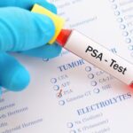 What if prostate cancer treatment could be reduced to just six months? A Spanish study opens a new avenue