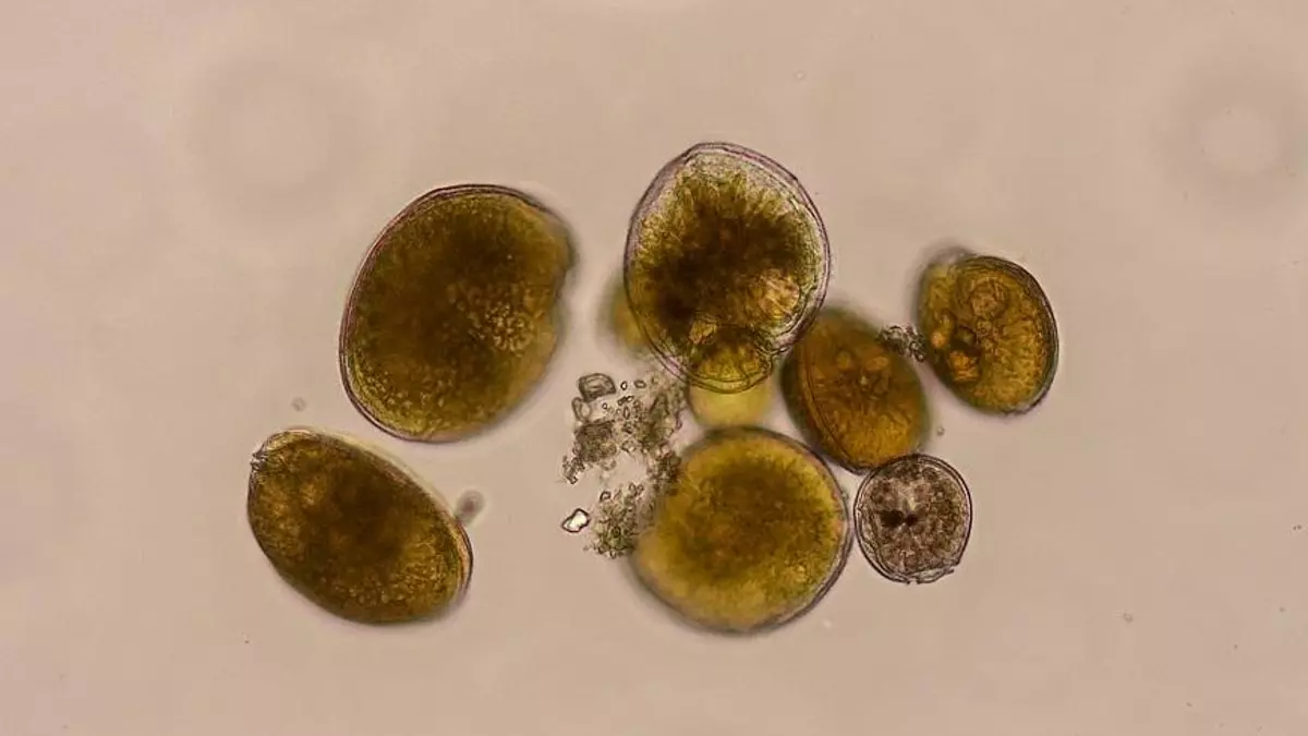 Gambierdiscus australes en microscopio