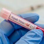 ¿Deberías preocuparte por el virus Nipah si viajas a Asia? Esto es lo que dicen los expertos