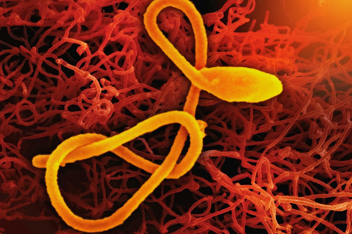 Ébola